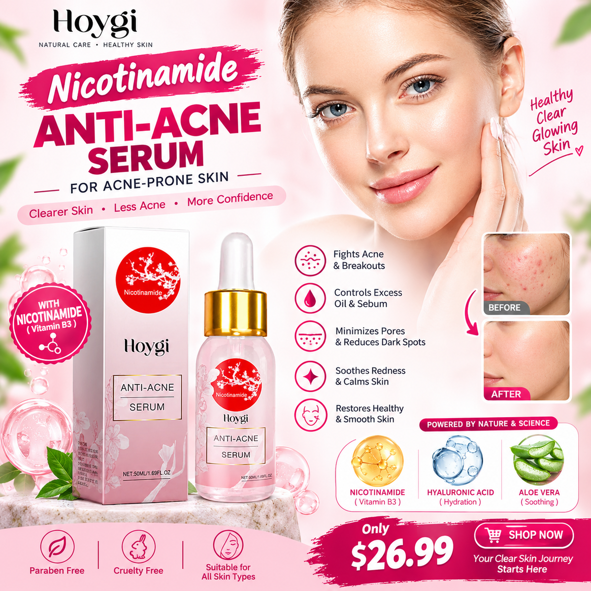 Nicotinamide anti-acne serum for acne-prone skin