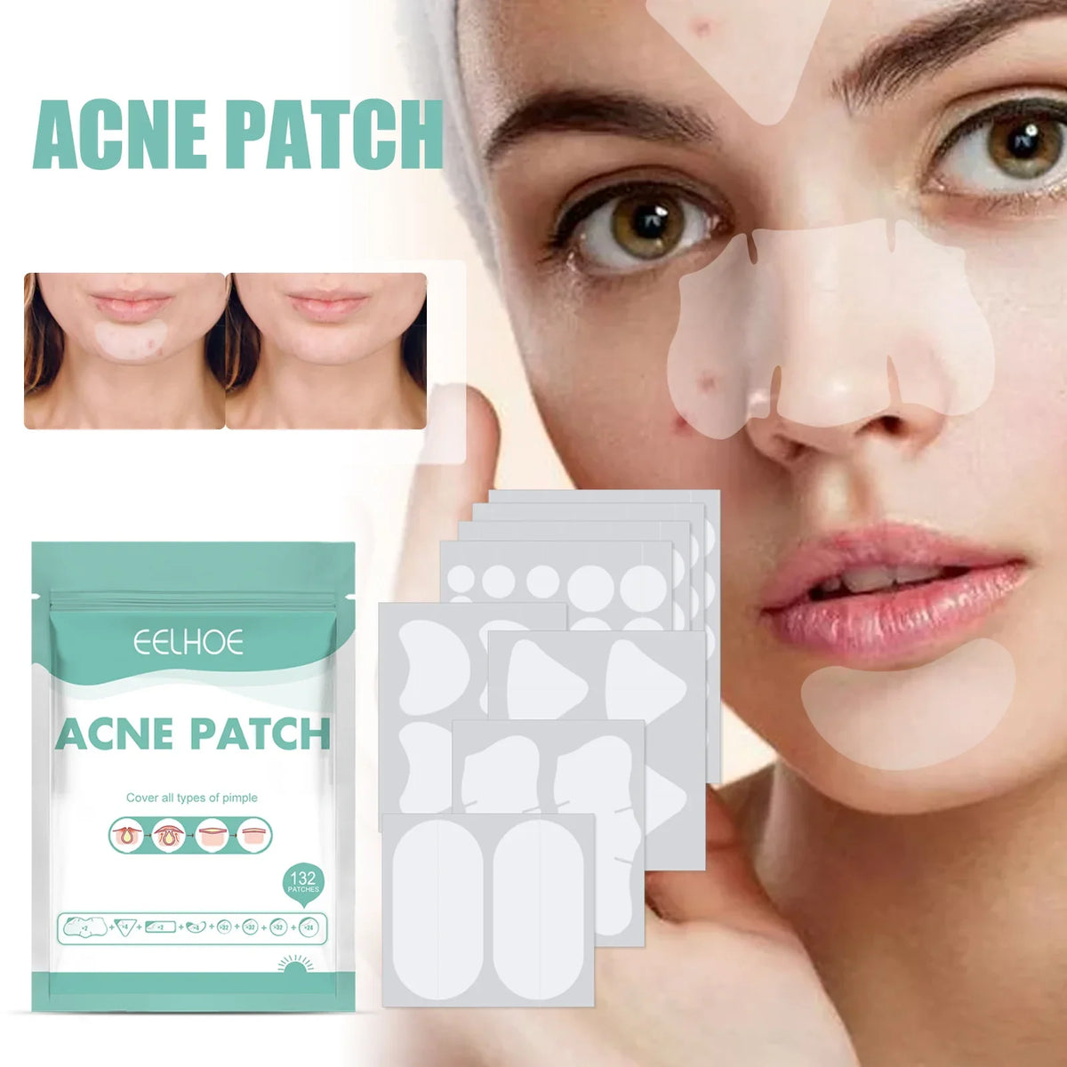 EELHOE Acne Pimple Patch with Salicylic Acid – Targeted Blemish Care for Clearer-Looking Skin