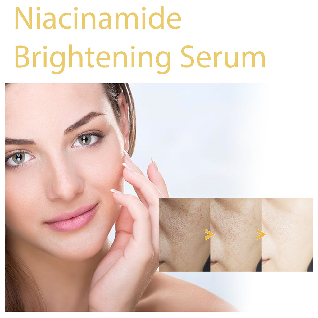 Niacinamide serum for uneven skin tone