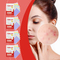 240pcs salicylic acid acne pimple patches colorful spot stickers