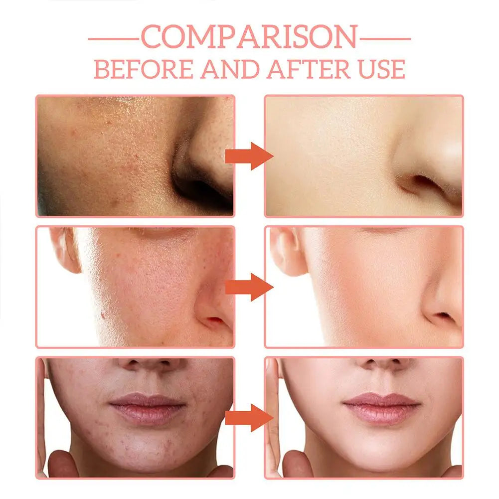 ✨ 5-in-1 Vitamin C & Hyaluronic Acid Face Serum – Hydrating & Brightening Skin Care