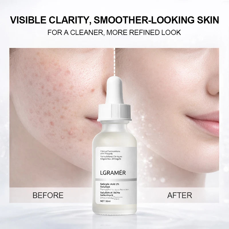 Salicylic Acid Serum for Oily and Blemish-Prone Skin