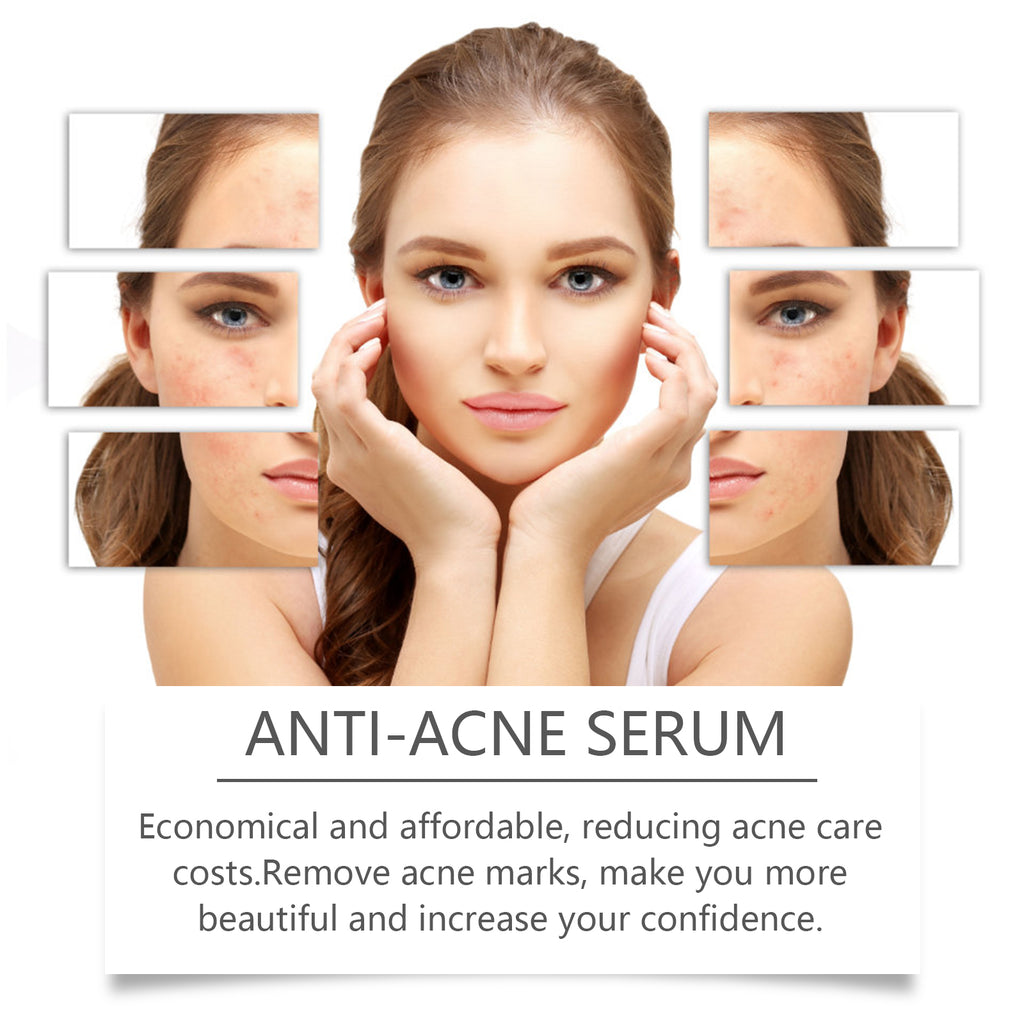 Hoygi Nicotinamide Anti-Acne Serum bottle